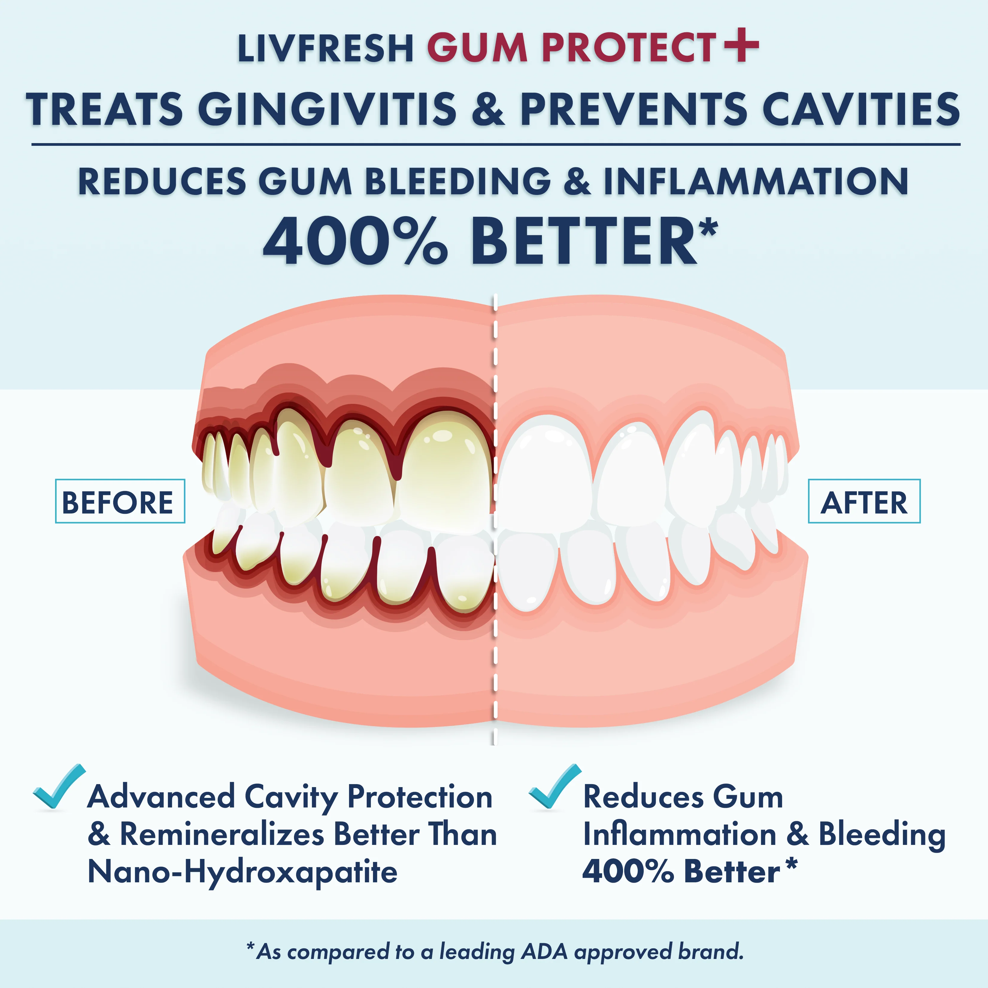 LIVFRESH Gum Protect Gel Toothpaste - Image 4
