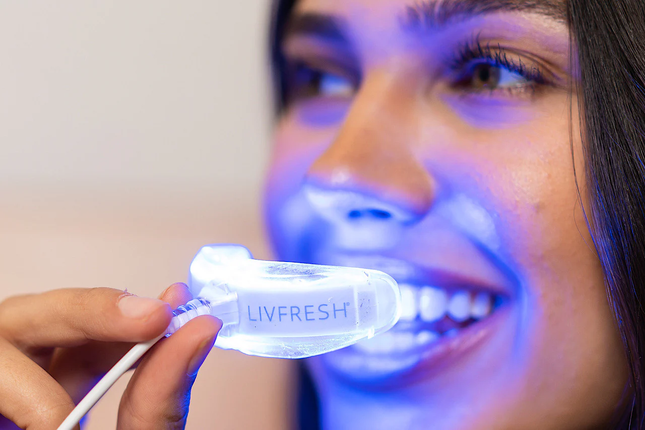 LIVFRESH Mobile Whitening System - Image 5